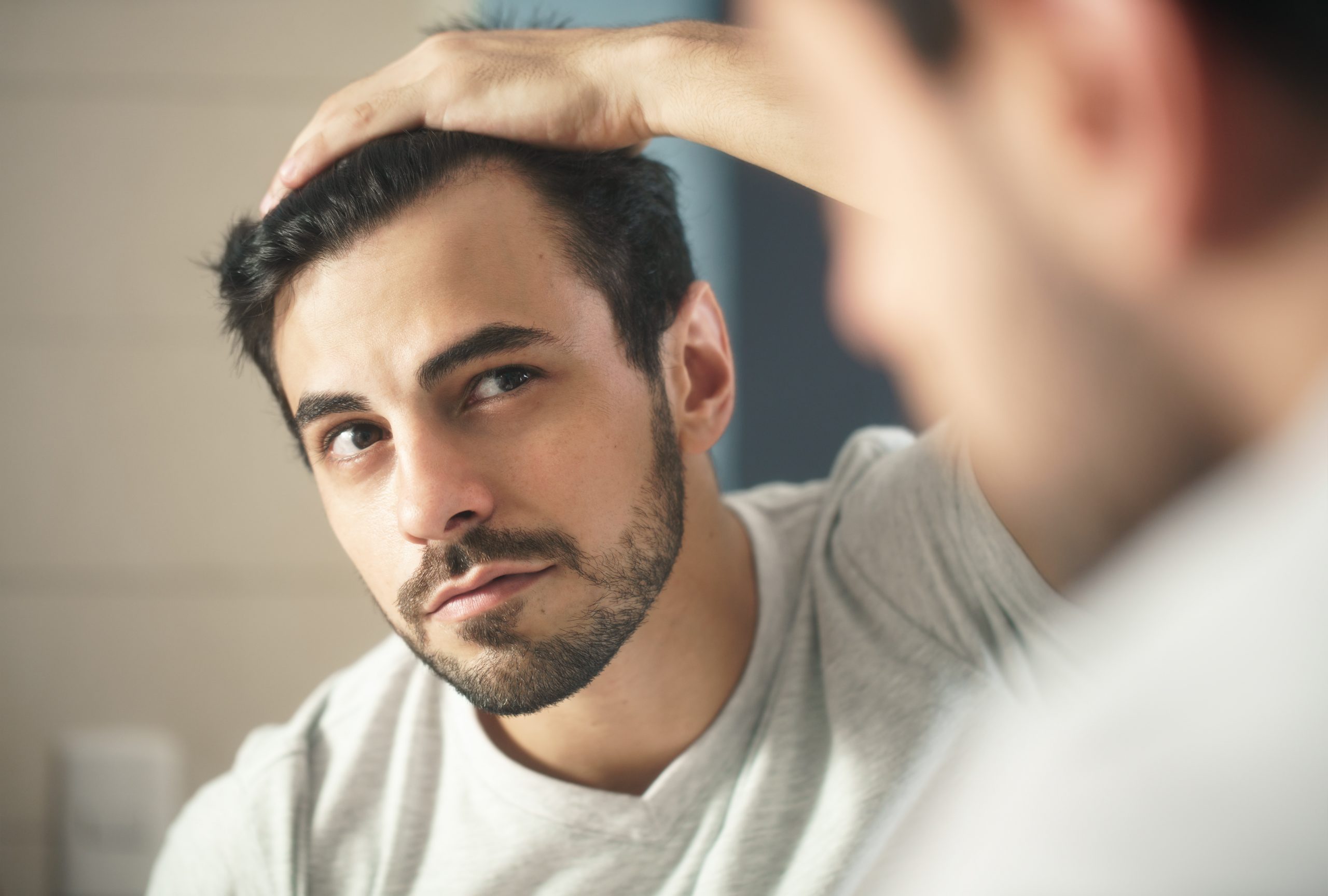 Male pattern baldness – causes and treatment